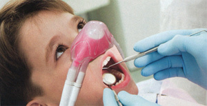 Nitroux Oxide (Laughing Gas)